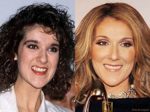 asp_620_mosoly_Celine-Dion